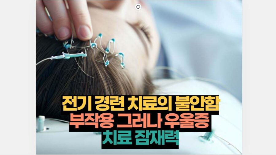 전기 경련 치료의 불안함 부작용 그러나 우울증  치료 잠재력