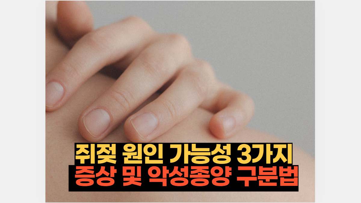 쥐젖 원인 가능성 3가지와 증상 및 악성종양 구분법 | 2026