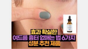 효과 확실한  여드름 흉터 없애는 법 6가지  성분 추천 제품
