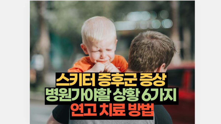 스키터 증후군 증상  병원가야할 상황 6가지  연고 치료 방법